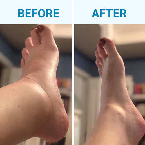 MindInsole Compression Socks